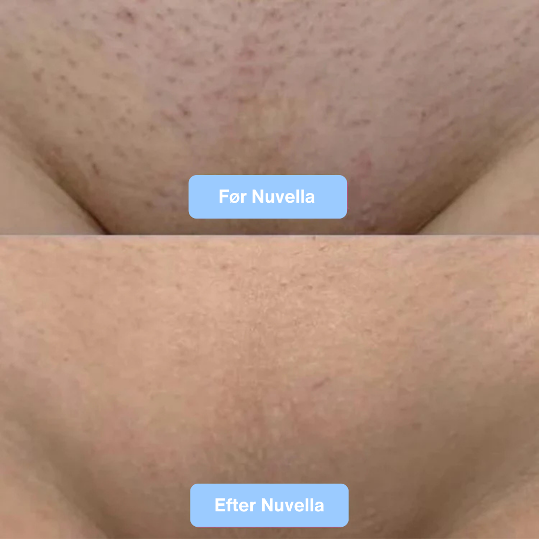Nuvella Silky