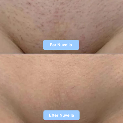 Nuvella Silky