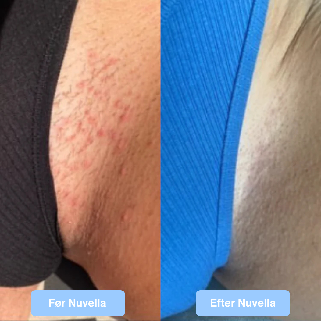 Nuvella Silky